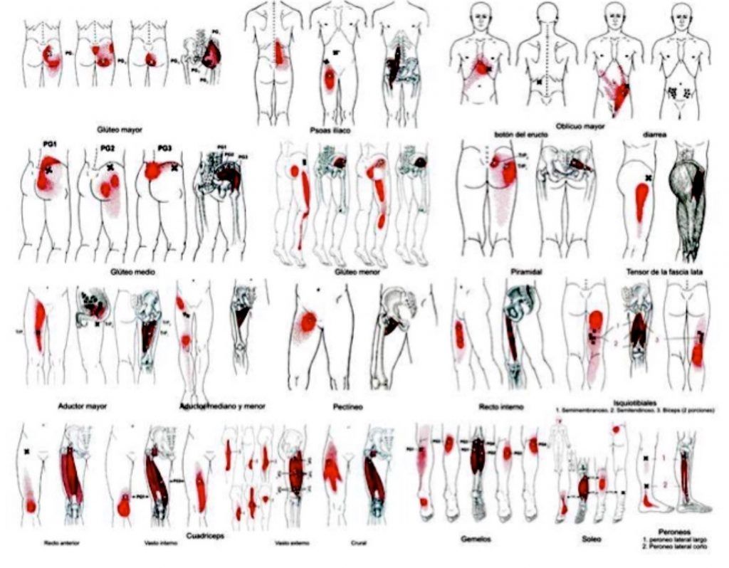 Puntos Gatillo ALTERMEDIC